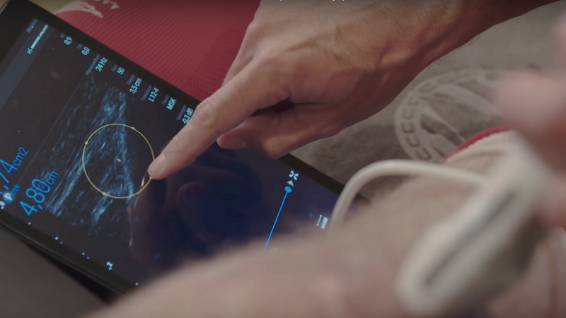 PSV Eindhoven nutzt mobile Ultraschall-Lösung