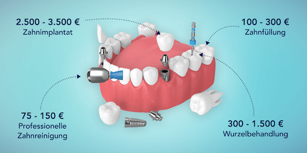 Kostenbeispiele ottonova Zahnzusatzversicherung