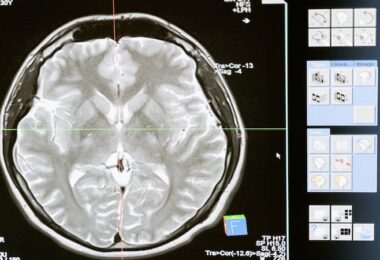 Neuralink plant Menschenversuch