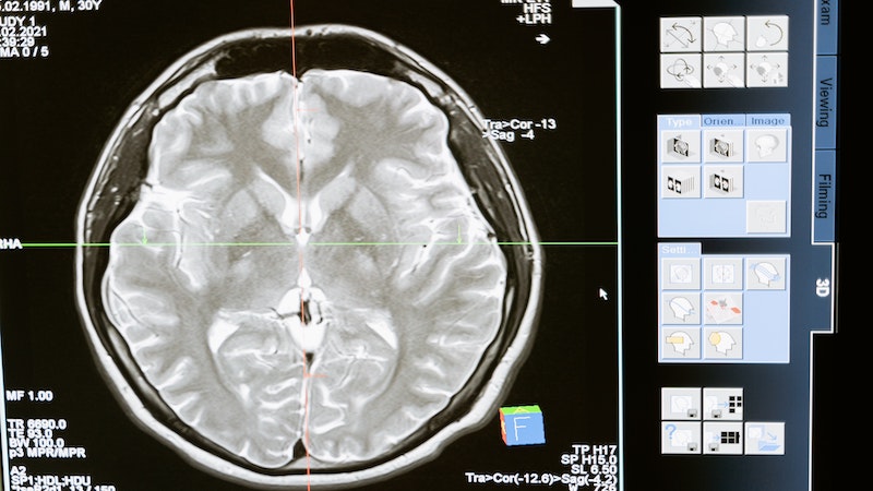 Neuralink plant Menschenversuch