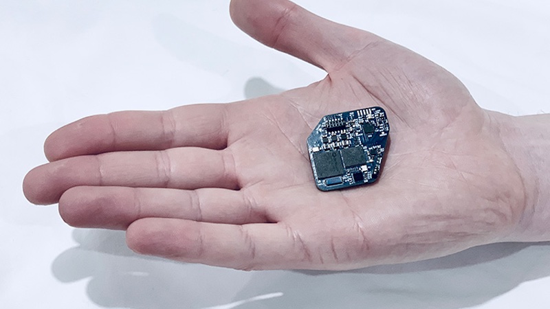 This wireless brain implant is said to help with epilepsy and Parkinson’s disease