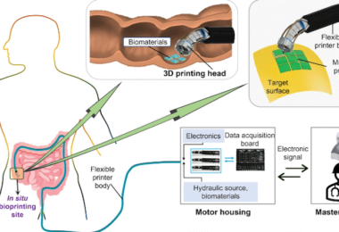 Cyborgs, Roboterarm, Druck, Mensch, Medizin, Behandlung