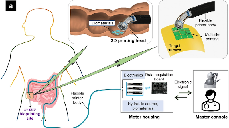 Robotic arm to print tissue inside our body