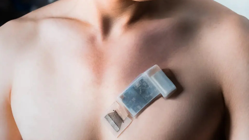 This portable ultrasound patch can monitor tissue