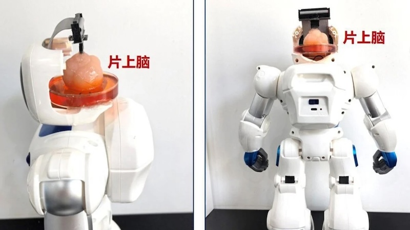 Roboter Gehirn, menschliche Stammzellen, Universität, China, Forschung, Entwicklung, Technologie, Mensch, Körper, Organ, Brain, Wissenschaft, Medizin, Biologie, Gesundheit