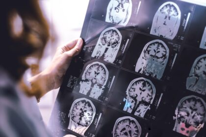 KI Gehirn verkümmern Auswirkungen Künstliche Intelligenz ChatGPT