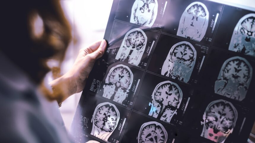 KI Gehirn verkümmern Auswirkungen Künstliche Intelligenz ChatGPT