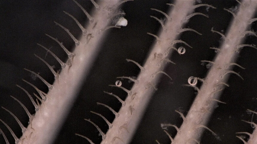 Mikroplastikfilter Mikroplastikfilter Waschmaschine Mikroplastik Plastik Umweltverschmutzung